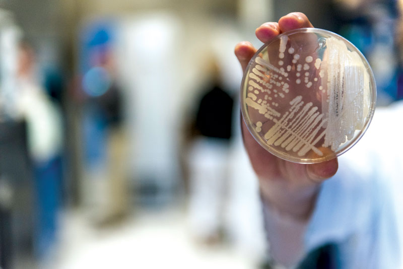 Yeast in a Petri dish